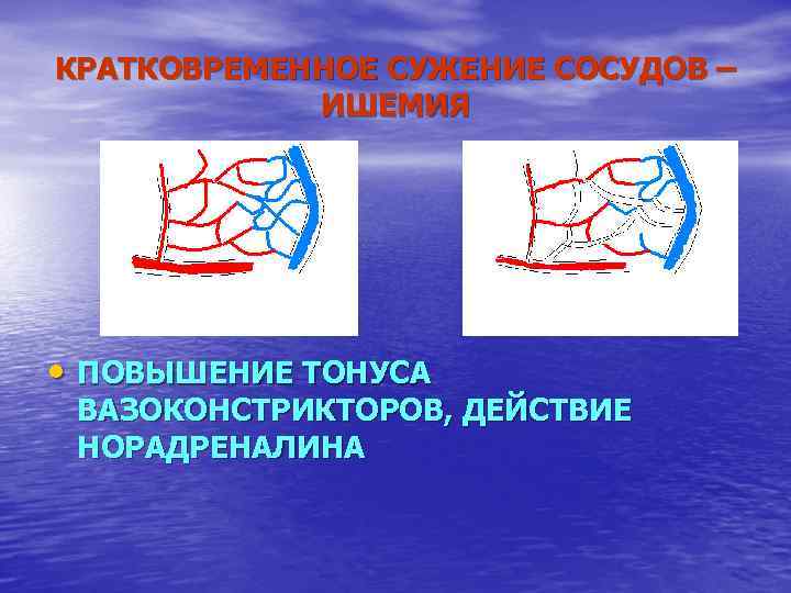 КРАТКОВРЕМЕННОЕ СУЖЕНИЕ СОСУДОВ – ИШЕМИЯ • ПОВЫШЕНИЕ ТОНУСА ВАЗОКОНСТРИКТОРОВ, ДЕЙСТВИЕ НОРАДРЕНАЛИНА 