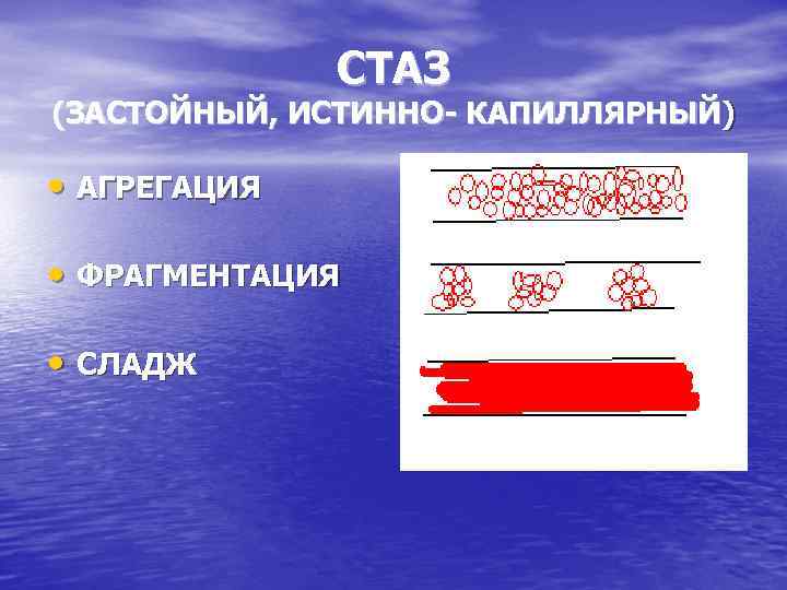 СТАЗ (ЗАСТОЙНЫЙ, ИСТИННО- КАПИЛЛЯРНЫЙ) • АГРЕГАЦИЯ • ФРАГМЕНТАЦИЯ • СЛАДЖ 