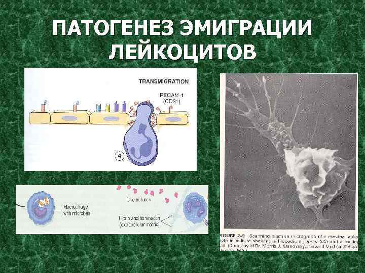 ПАТОГЕНЕЗ ЭМИГРАЦИИ ЛЕЙКОЦИТОВ 