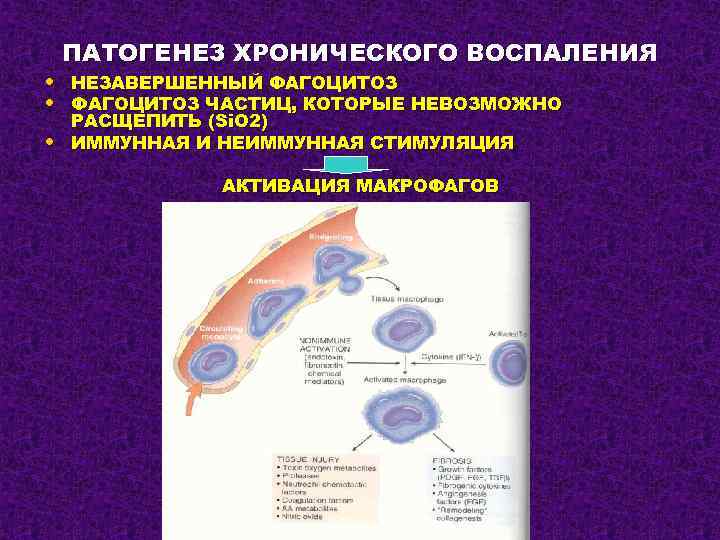 ПАТОГЕНЕЗ ХРОНИЧЕСКОГО ВОСПАЛЕНИЯ • НЕЗАВЕРШЕННЫЙ ФАГОЦИТОЗ • ФАГОЦИТОЗ ЧАСТИЦ, КОТОРЫЕ НЕВОЗМОЖНО • РАСЩЕПИТЬ (Si.