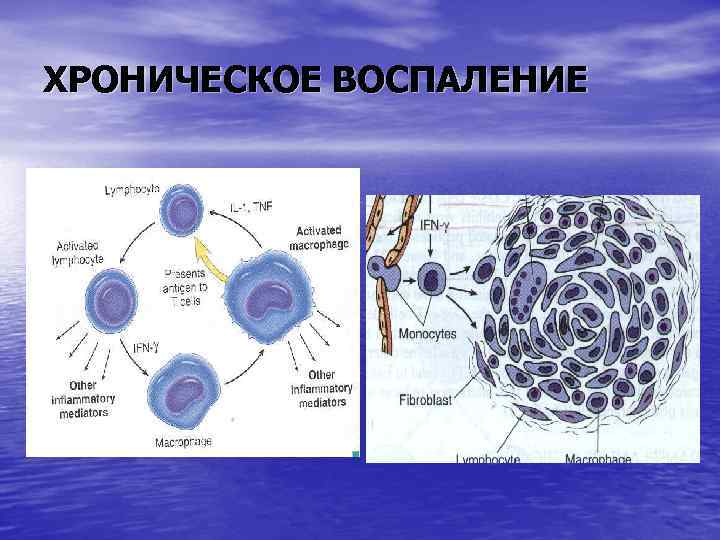 ХРОНИЧЕСКОЕ ВОСПАЛЕНИЕ 