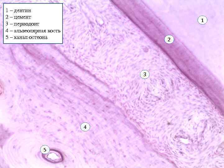 1 – дентин 2 – цемент 3 – периодонт 4 – альвеолярная кость 5