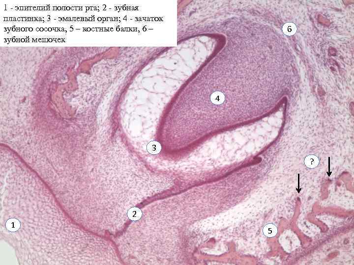 1 - эпителий полости рта; 2 - зубная пластинка; 3 - эмалевый орган; 4