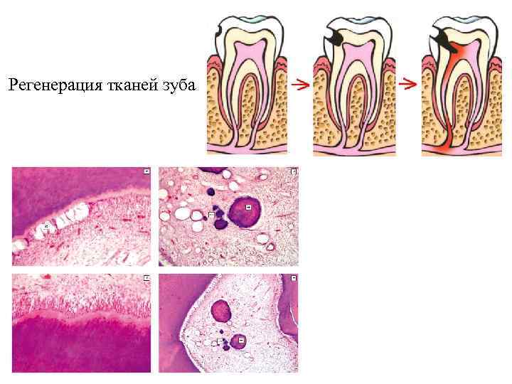 Регенерация тканей зуба 