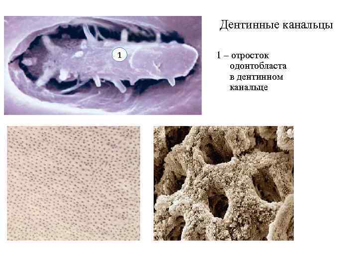 Дентинные канальцы зуба фото