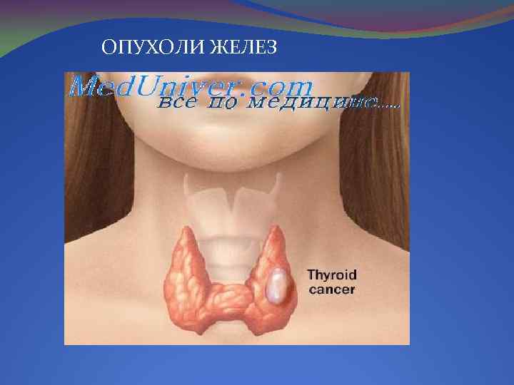 ОПУХОЛИ ЖЕЛЕЗ 