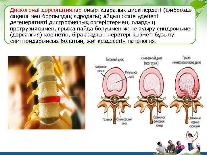 Дискогенді дорсопатиялар омыртқааралық дискілердегі (фиброзды сақина мен борпылдақ ядродағы) айқын және үдемелі дегенеративті дистрофиялық