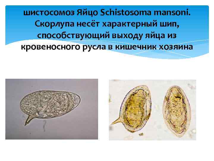шистосомоз Яйцо Schistosoma mansoni. Скорлупа несёт характерный шип, способствующий выходу яйца из кровеносного русла