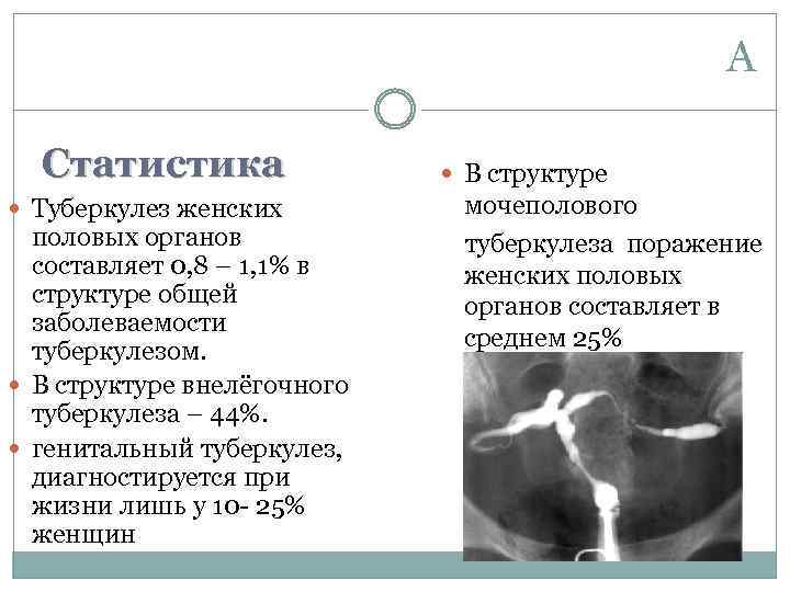 А Статистика Туберкулез женских половых органов составляет 0, 8 – 1, 1% в структуре