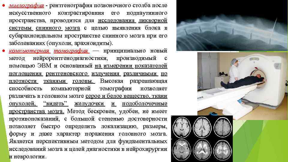 После искусственного. Рентгенография спинного мозга. Методы обследования спинного мозга. Миелография (исследование субарахноидального пространства. Миелография головного мозга.