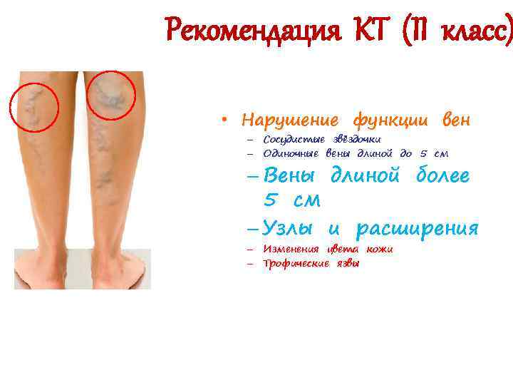 Рекомендация КТ (II класс) • Нарушение функции вен – Сосудистые звёздочки – Одиночные вены