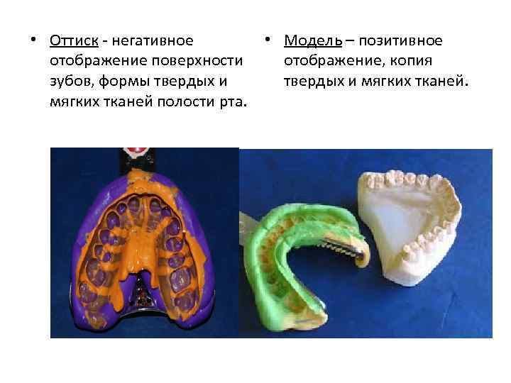  • Оттиск - негативное отображение поверхности зубов, формы твердых и мягких тканей полости