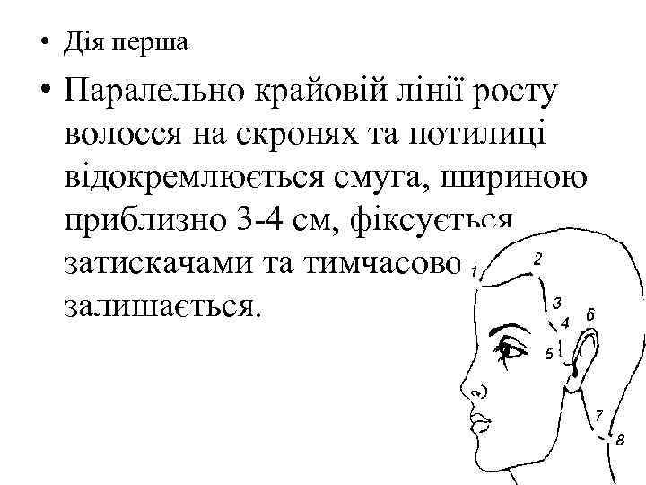  • Дія перша • Паралельно крайовій лінії росту волосся на скронях та потилиці