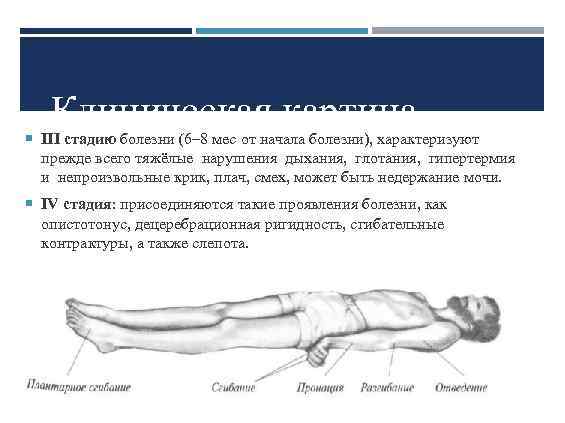 Клиническая картина III стадию болезни (6– 8 мес от начала болезни), характеризуют прежде всего