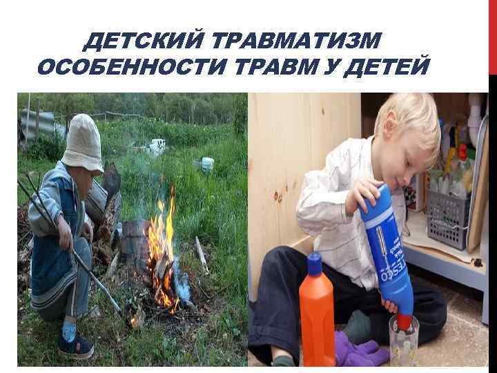 ДЕТСКИЙ ТРАВМАТИЗМ ОСОБЕННОСТИ ТРАВМ У ДЕТЕЙ 