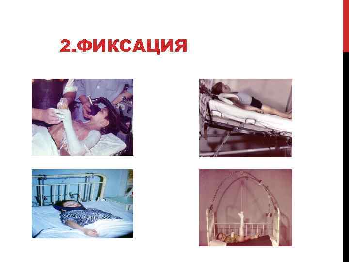 2. ФИКСАЦИЯ 