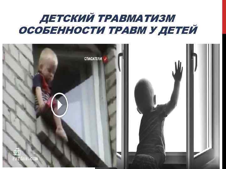 ДЕТСКИЙ ТРАВМАТИЗМ ОСОБЕННОСТИ ТРАВМ У ДЕТЕЙ 