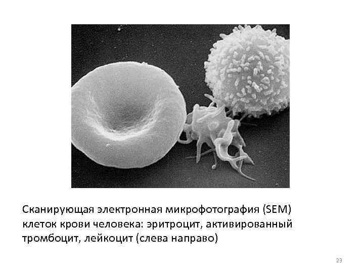 Cканирующая электронная микрофотография (SEM) клеток крови человека: эритроцит, активированный тромбоцит, лейкоцит (слева направо) 23