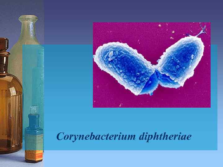 Corynebacterium diphtheriae 