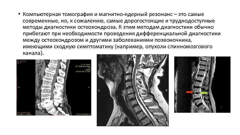  • Компьютерная томография и магнитно-ядерный резонанс – это самые современные, но, к сожалению,