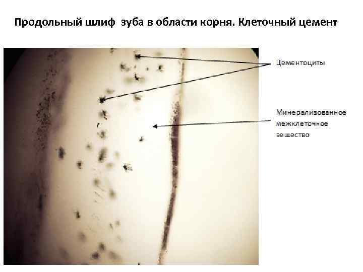 Продольный шлиф зуба в области корня. Клеточный цемент 