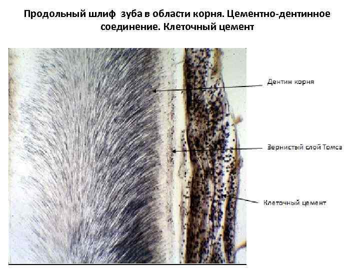 Продольный шлиф зуба в области корня. Цементно-дентинное соединение. Клеточный цемент 