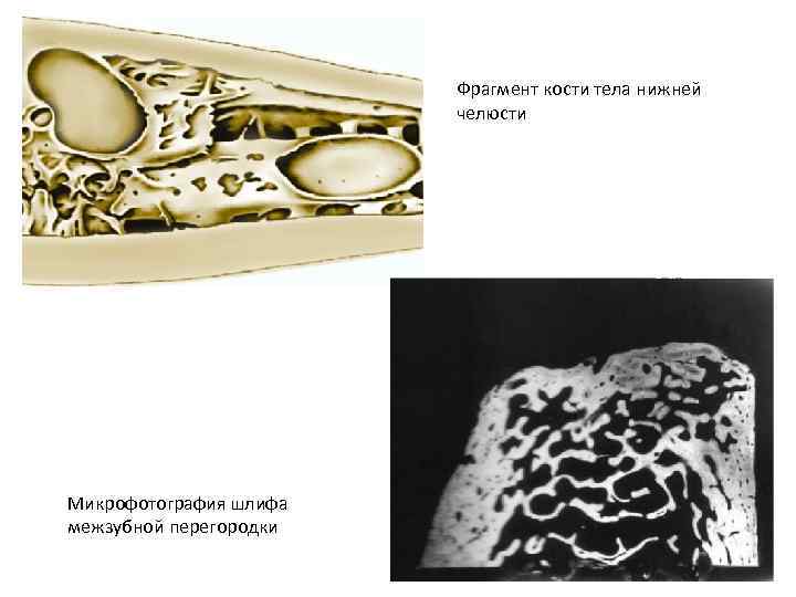 Фрагмент кости тела нижней челюсти Микрофотография шлифа межзубной перегородки 