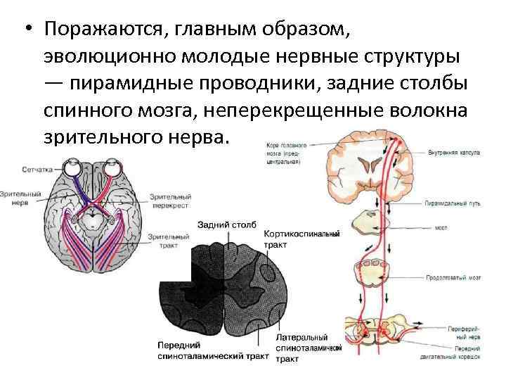  • Поражаются, главным образом, эволюционно молодые нервные структуры — пирамидные проводники, задние столбы