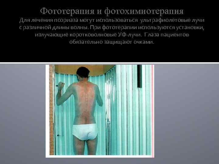 Фототерапия и фотохимиотерапия Для лечения псориаза могут использоваться ультрафиолетовые лучи с различной длины волны.