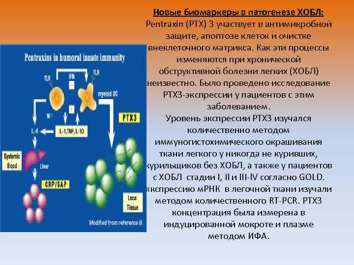 Новые биомаркеры в патогенезе ХОБЛ: Pentraxin (PTX) 3 участвует в антимикробной защите, апоптозе клеток