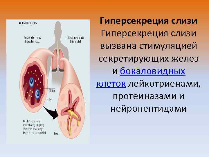 Гиперсекреция это