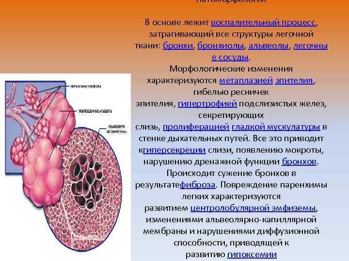 Бронхиолы стенка. Структура ткани бронхов. Гипоксемия. Стенка бронхиол образована тканью. Гипоксемия sp02.