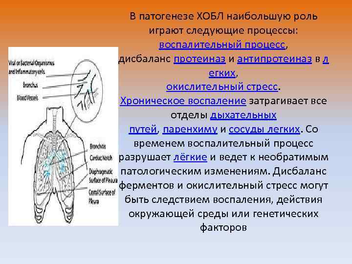 В патогенезе ХОБЛ наибольшую роль играют следующие процессы: воспалительный процесс, дисбаланс протеиназ и антипротеиназ