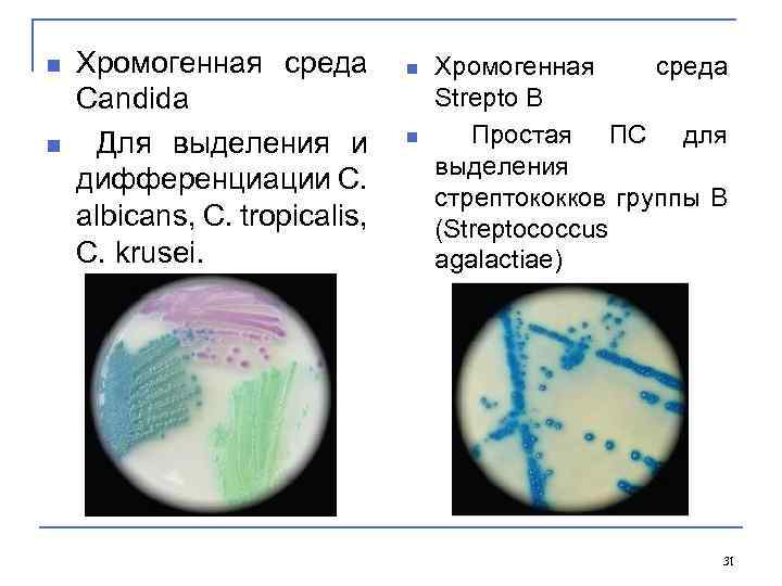 n n Хромогенная среда Candida Для выделения и дифференциации C. albicans, C. tropicalis, C.