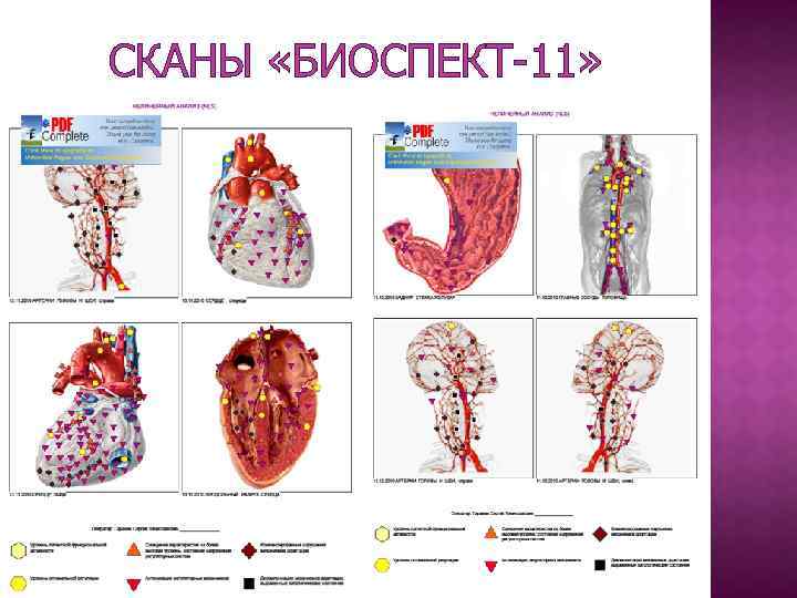 СКАНЫ «БИОСПЕКТ-11» 