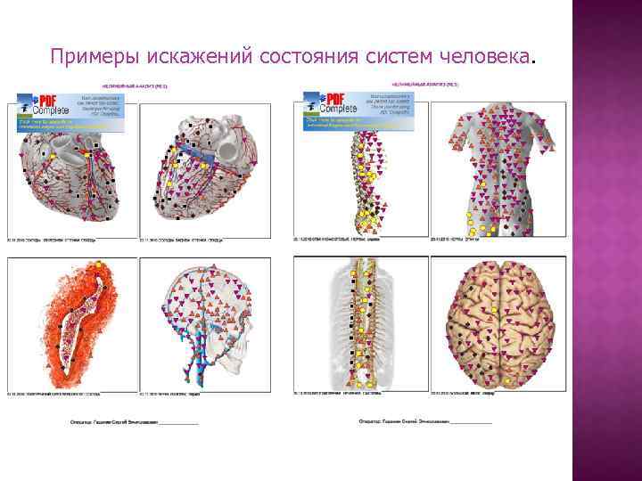 Примеры искажений состояния систем человека. 