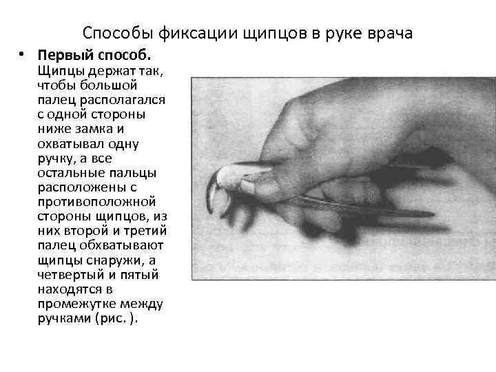 Способы фиксации щипцов в руке врача • Первый способ. Щипцы держат так, чтобы большой