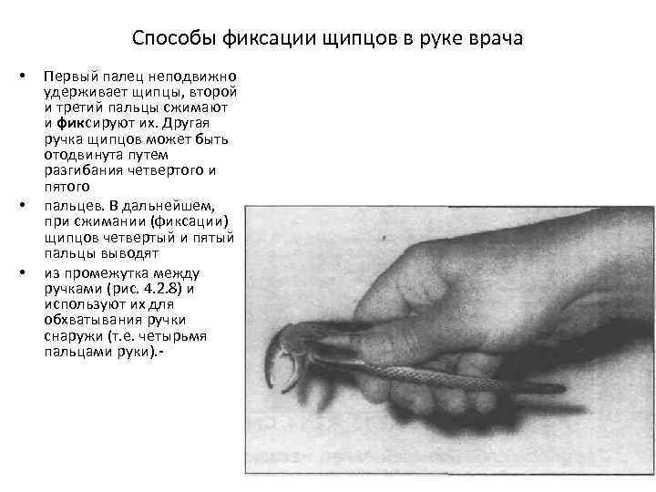 Способы фиксации щипцов в руке врача • • • Первый палец неподвижно удерживает щипцы,