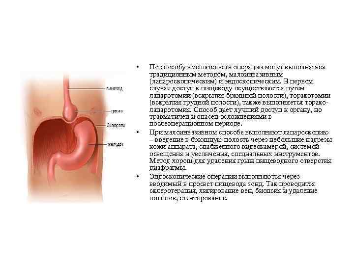  • • • По способу вмешательств операции могут выполняться традиционным методом, малоинвазивным (лапароскопическим)