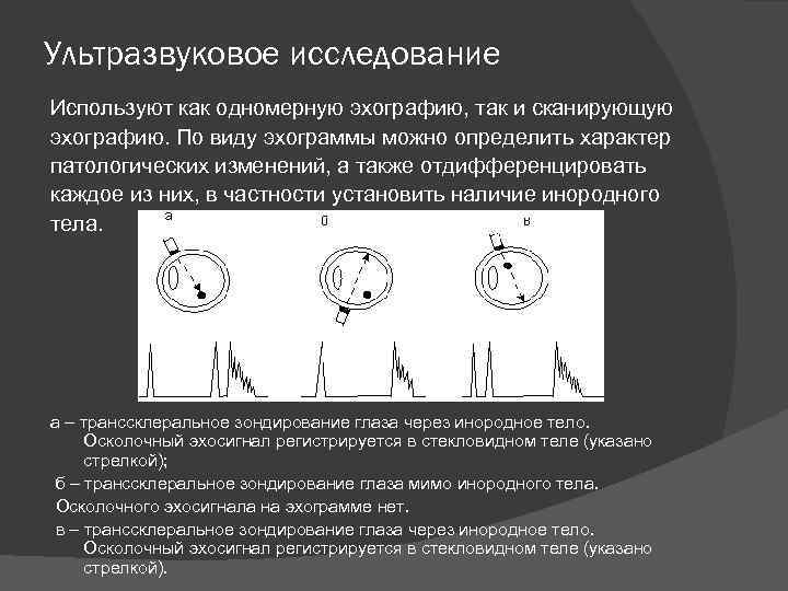 Ультразвуковое исследование Используют как одномерную эхографию, так и сканирующую эхографию. По виду эхограммы можно