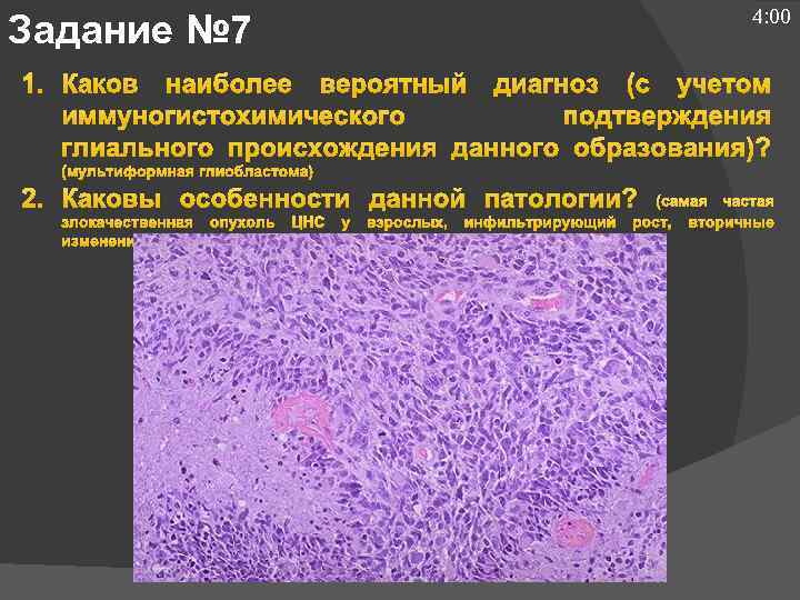 4: 00 Задание № 7 1. Каков наиболее вероятный диагноз (с учетом иммуногистохимического подтверждения