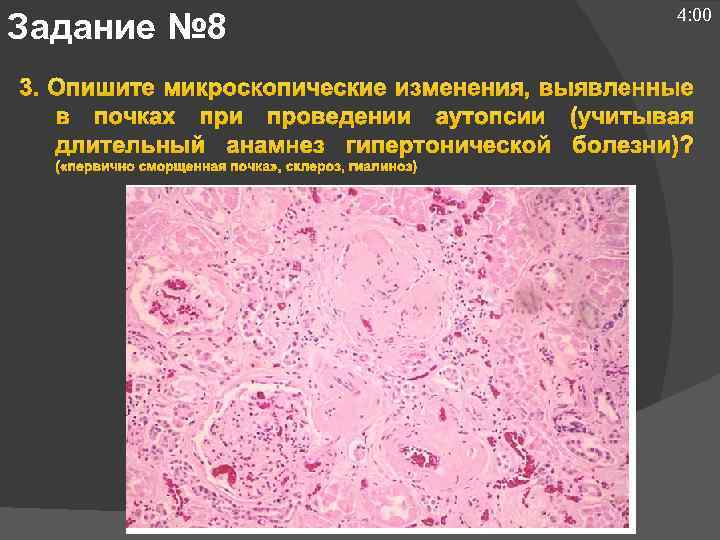 Задание № 8 4: 00 3. Опишите микроскопические изменения, выявленные в почках при проведении