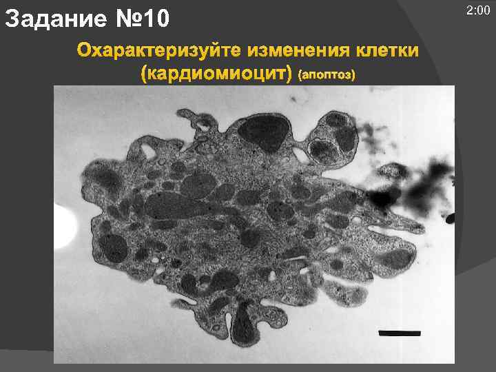 Задание № 10 Охарактеризуйте изменения клетки (кардиомиоцит) (апоптоз) 2: 00 