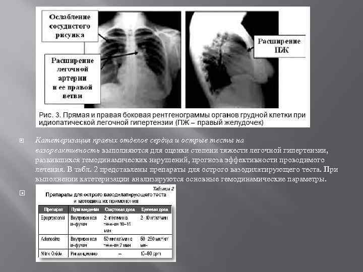  Катетеризация правых отделов сердца и острые тесты на вазореактивность выполняются для оценки степени