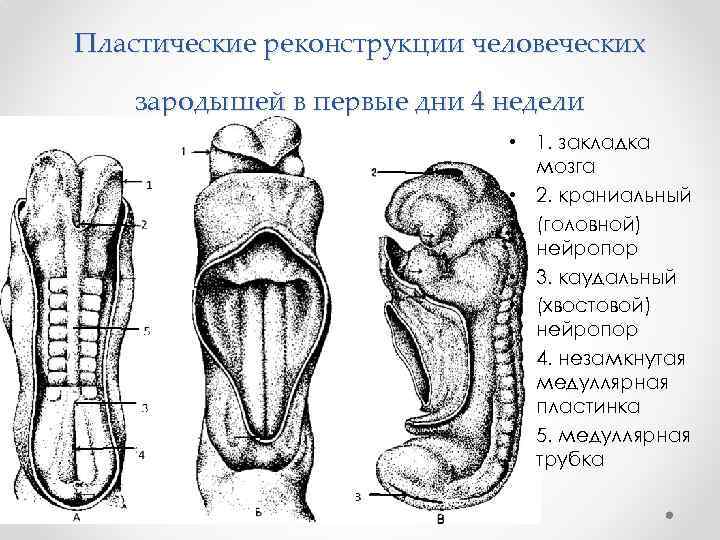 Пластические реконструкции человеческих зародышей в первые дни 4 недели • 1. закладка мозга •