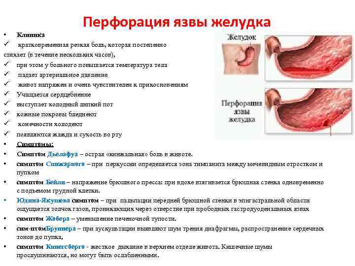 Перфорация язвы желудка • Клиника ü кратковременная резкая боль, которая постепенно стихает (в течение