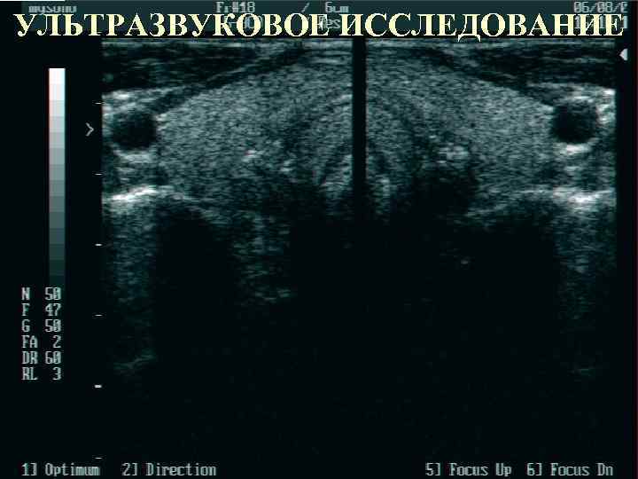 УЛЬТРАЗВУКОВОЕ ИССЛЕДОВАНИЕ 