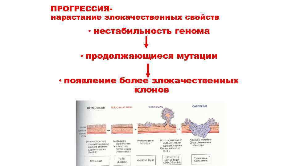 ПРОГРЕССИЯнарастание злокачественных свойств • нестабильность генома • продолжающиеся мутации • появление более злокачественных клонов