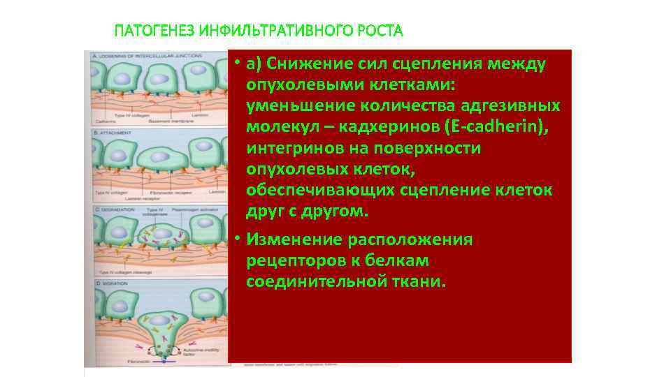 ПАТОГЕНЕЗ ИНФИЛЬТРАТИВНОГО РОСТА • а) Снижение сил сцепления между опухолевыми клетками: уменьшение количества адгезивных