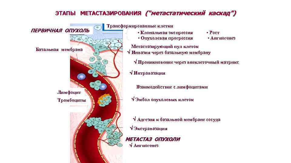 ЭТАПЫ МЕТАСТАЗИРОВАНИЯ (“метастатический каскад”) ПЕРВИЧНАЯ ОПУХОЛЬ Базальная мембрана Трансформированные клетки • Клональная экспрессия •